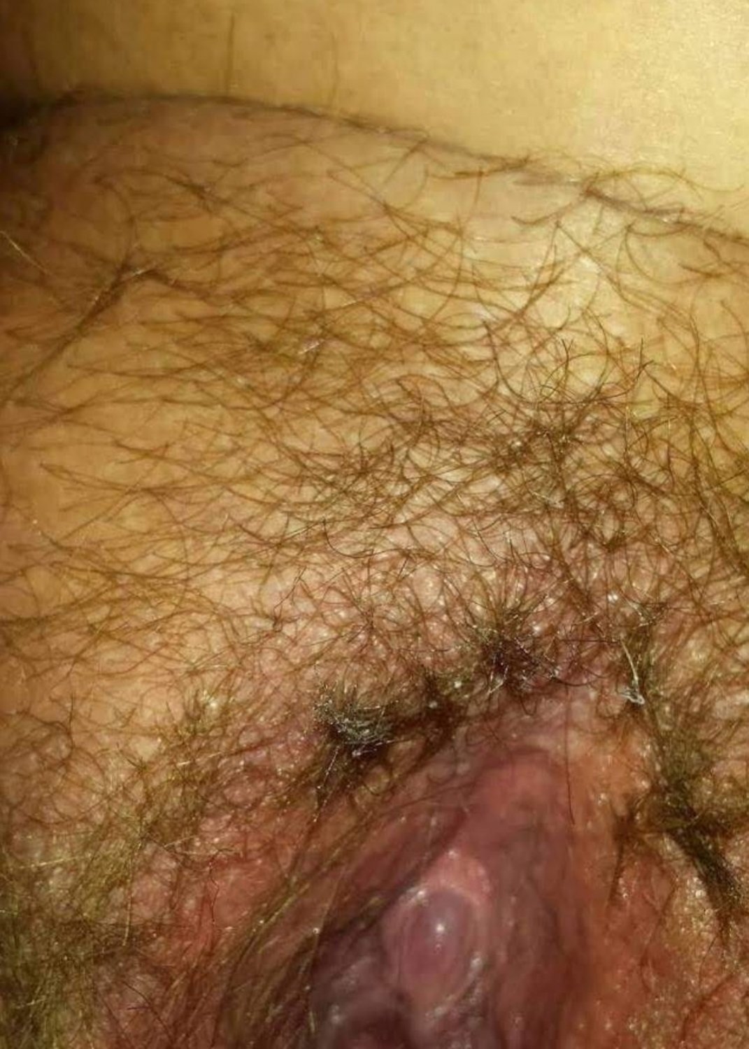 Just the clit π #1gtsxI1q